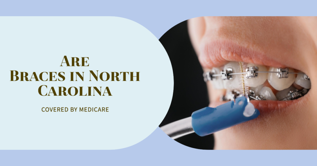 How Much Do Braces Cost in North Carolina with Medicare